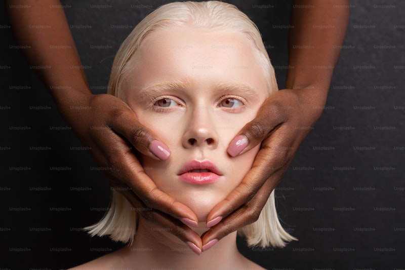 Beyaz Kas Hastalığı Nedir Beyaz Kas Hastalığı Nedir